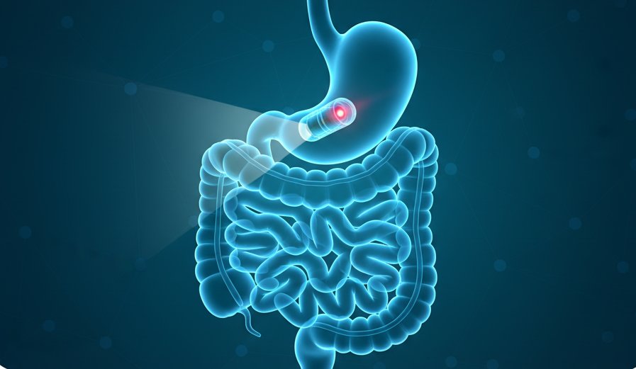 Capsule Endoscopy in Ahmedabad